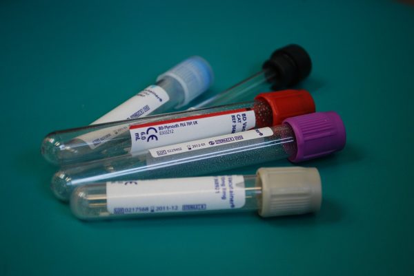 Krwiodawstwo sposobem na niższe podatki 1 Krew w ampułkach, laboratorium